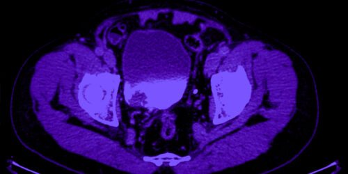 Close-up of an MRI Scan